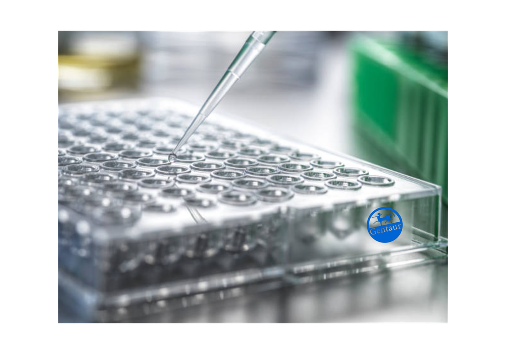 ELISA  Acetyl-HIST1H2BB (K5) anti-